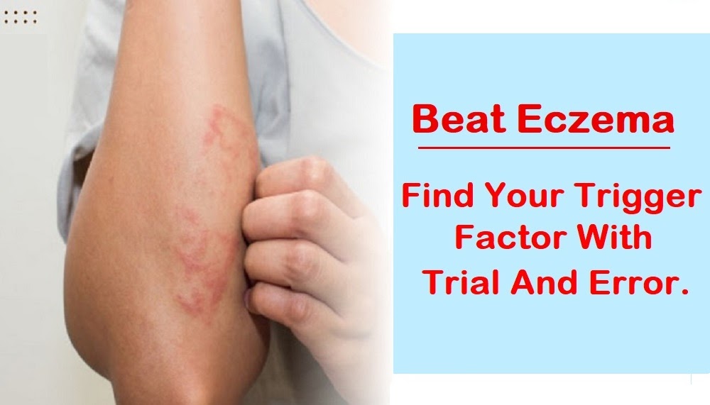 Beat Eczema Find Your Trigger Factor with Trial and Error.