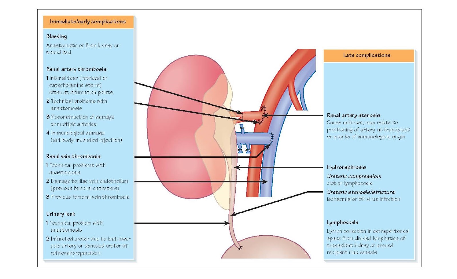 Surgical Complications Of Kidney Transplantation pediagenosis