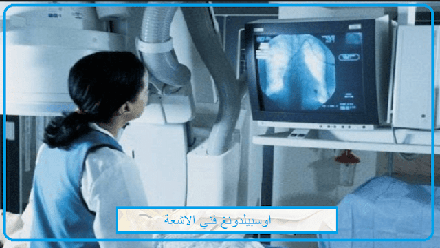 اوسبلدونغ فني الأشعة Medizinisch-technische/r Radiologieassistent/in