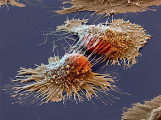 [Image: benh-ung-thu-14.jpg]