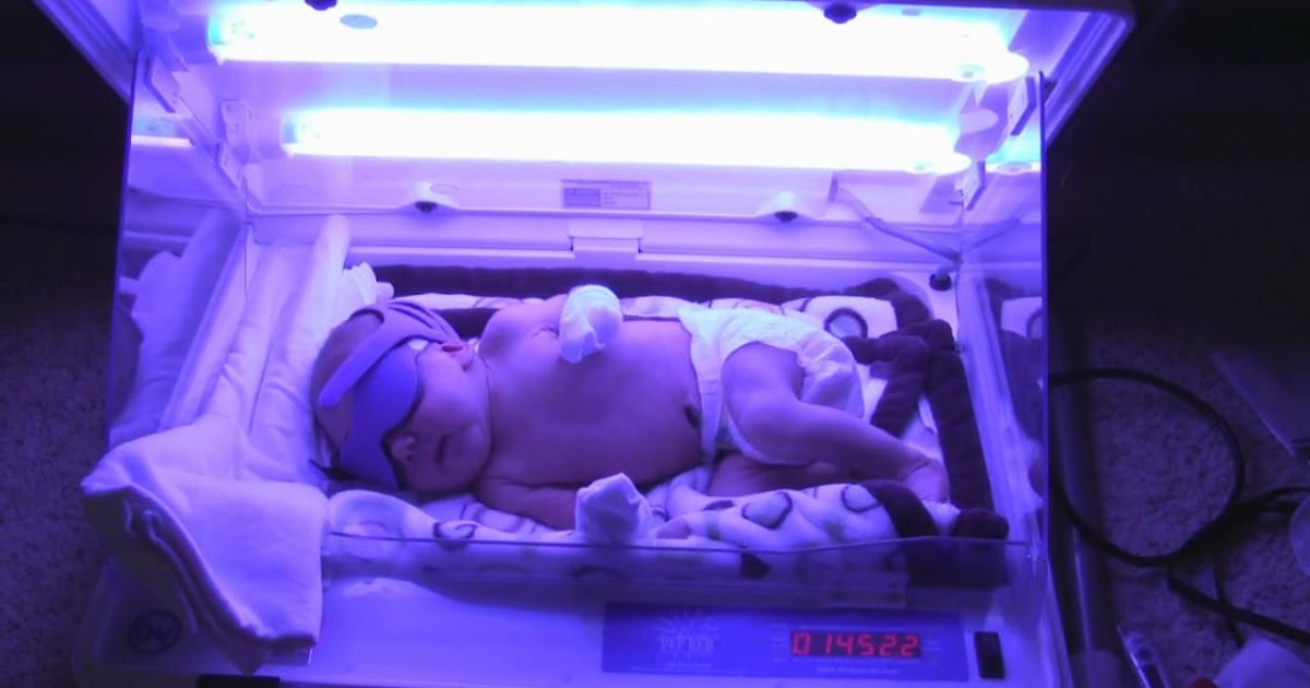 Assistencia de Enfermagem ao recém nascido submetido à fototerapia