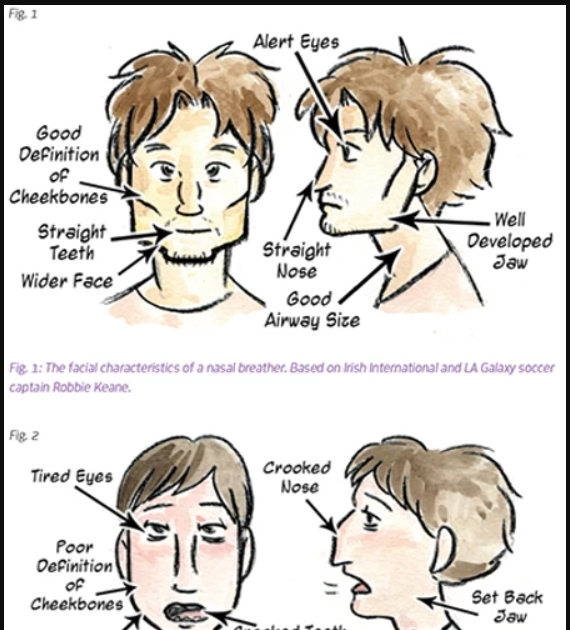 Mouth Breathers vs Nasal Breathers