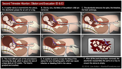 DE-6-panel-1.jpg