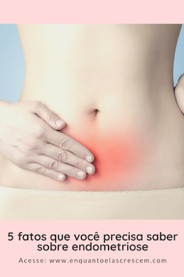 5 fatos que você precisa saber sobre endometriose
