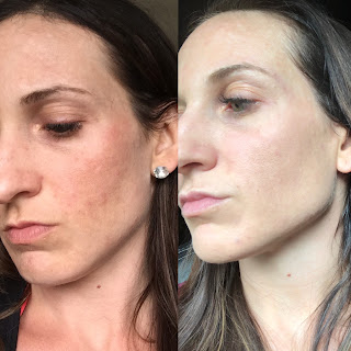 muac mandelic acid toner