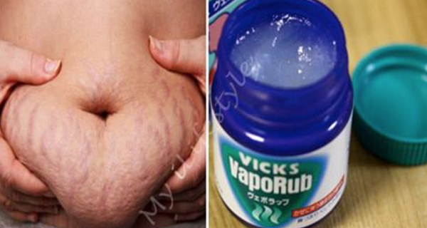 CÓMO UTILIZAR VICKS VAPORUB DESHACERSE DE VIENTRE ACUMULADO GRASA Y LA CELULITIS, ELIMINAR LAS ESTRÍAS Y TENER UNA PIEL MÁS FIRME CÓMO UTILIZAR VICKS VAPORUB DESHACERSE DE VIENTRE ACUMULADO GRASA Y LA CELULITIS, ELIMINAR LAS ESTRÍAS Y TENER UNA PIEL MÁS FIRME
