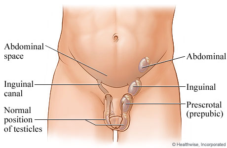 Boli testicule - secțiunea 2