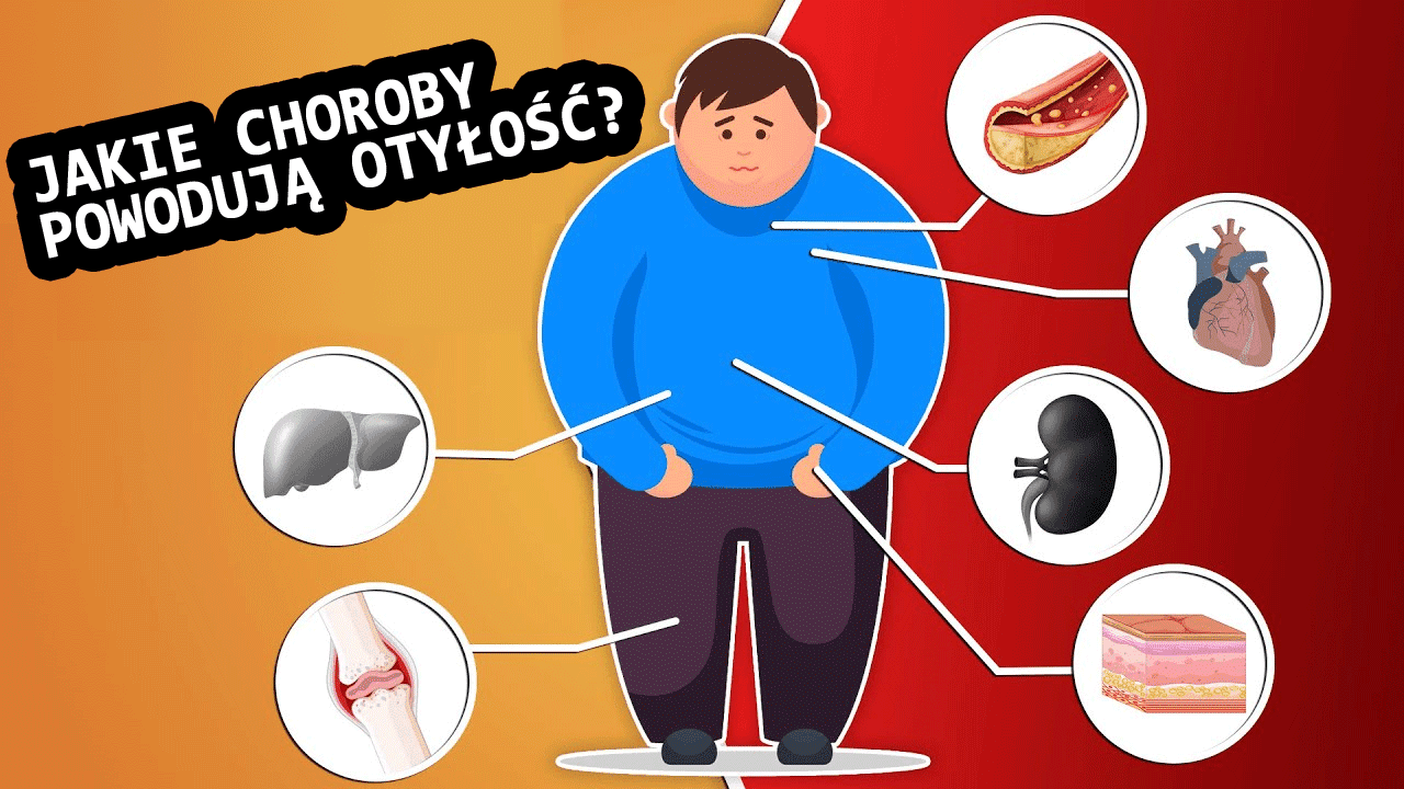 Jakie choroby powodują otyłość?