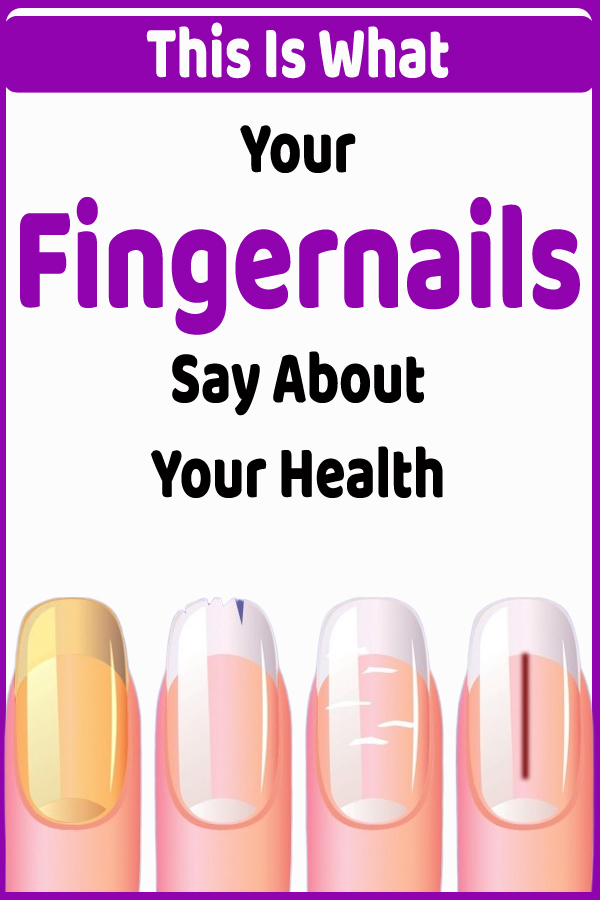 What Your Fingernails Say About Your Health