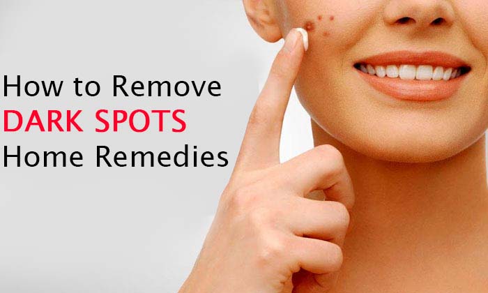 How to Remove Dark Spots Home Remedies