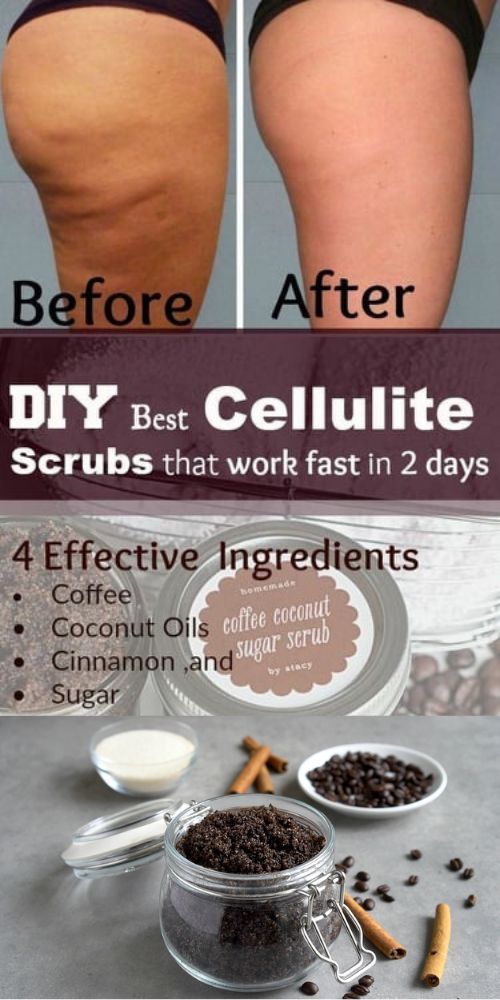 DIY Best Cellulite Scrub That Work Fast In 2 Days! With most Powerful