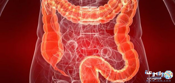 أعراض مرض سرطان القولون