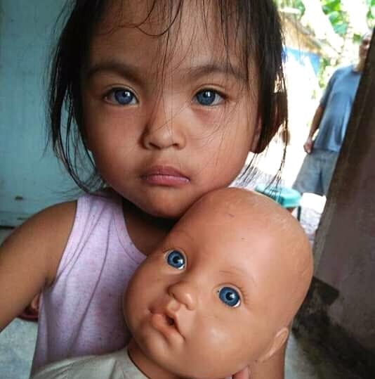 LOOK Why does this pure Filipino girl in Sarangani have blue eyes