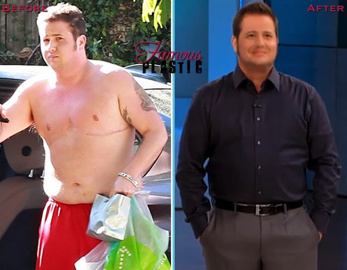 Chaz Bono Plastic Surgery Before And After Weight Loss Photos