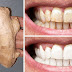 Oui, le gingembre et le sel permettent de blanchir les dents : voici comment les utiliser