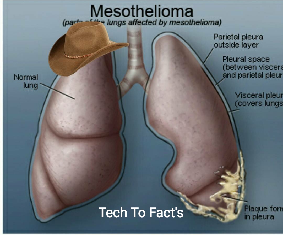 where is asbestos most commonly found