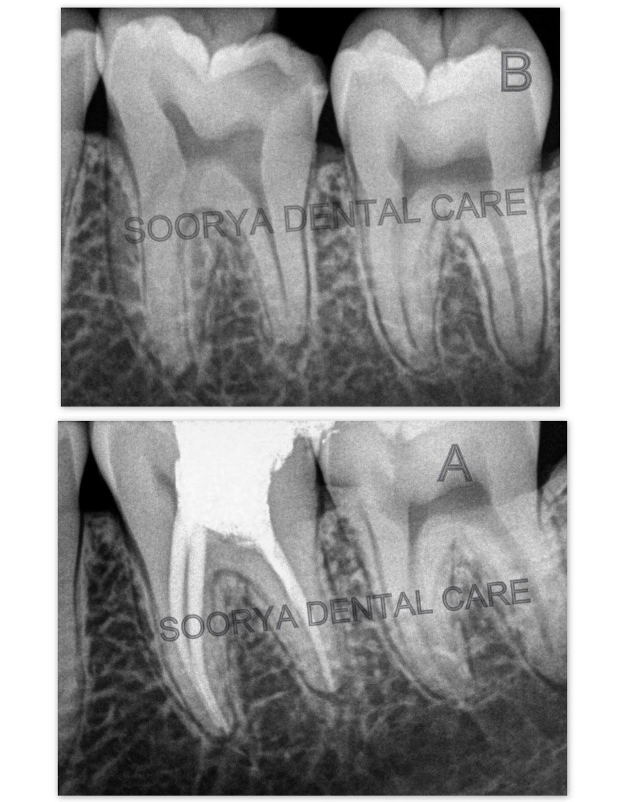 Dentist in Karaikudi BEST ROOT CANAL TREATMENT IN KARAIKUDI
