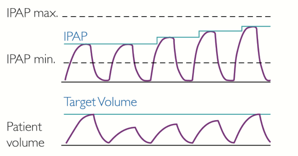 Czym są aparaty BiPAP z funkcją AVAPS (iVAPS)? CPAP blog leczenie