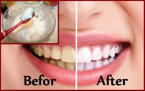 How To Whiten Teeth Instantly At Home Ayuhealthline Enhancing Life