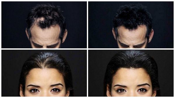 Best Hair Building Fibers For Thinning Hair Keratin Hair