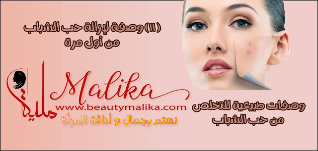 أكثر من وصفة لإزالة حب الشباب من أول مرة أكثر من وصفة لإزالة حب الشباب من أول مرة