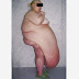 mujer deforme con enorme barriga