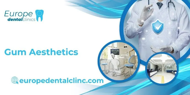 Gum Aesthetics - Europe Dental Clinic