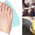 8 Easy Remedies On How To Get Rid Acidity Naturally Without Spending Too Much Money