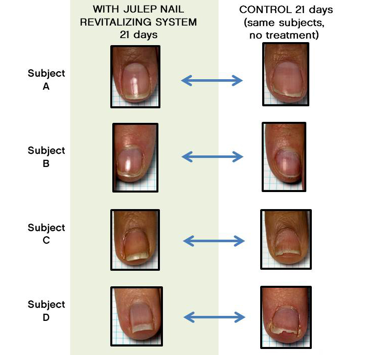 Erica's Nails and More: Julep Reveal Nail Growth Revitalizing Serum