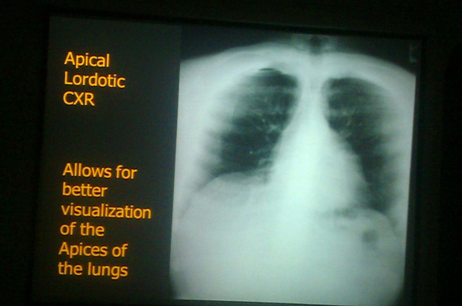 Lecture slides Radiology Chest X ray