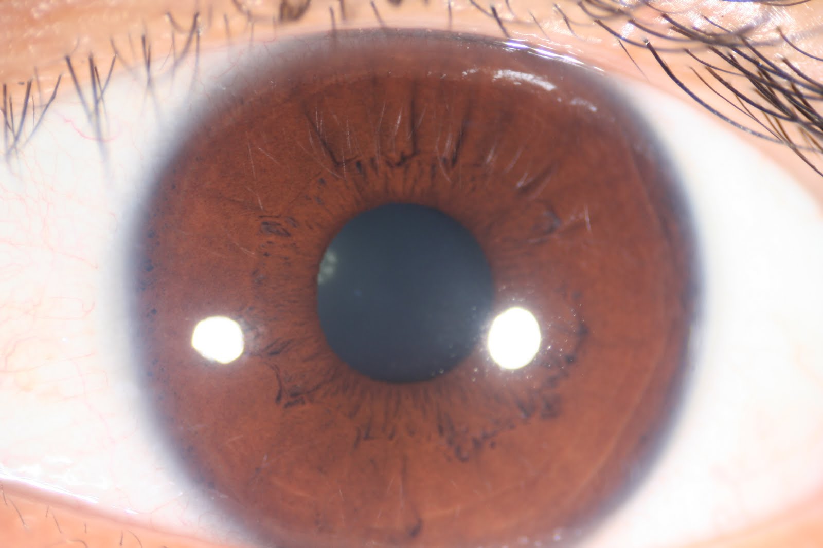 Modern & Multidimensional Iridology: Modern & Multidimensional ...