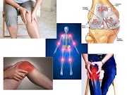 Cara Hilangkan Sakit Lutut Tanpa Pembedahan   .
