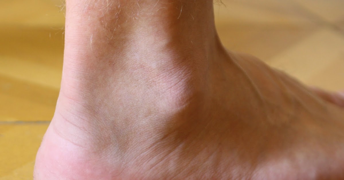 Top 5 Fridays! 5 Ankle Patterns Modern Manual Therapy Blog Manual