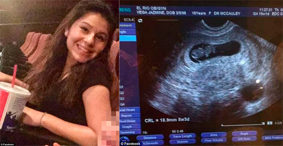 17 летняя девушка забеременела от рыбы