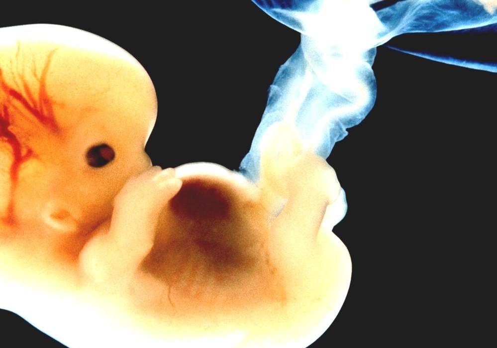 Human Cloning Clone A Human