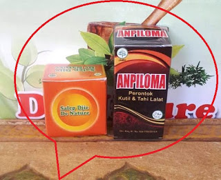 Jenis Nama Salep Kutil Kelamin Di Apotik Kimia Umum K24 Jenis Nama Salep Kutil Kelamin Di Apotik Kimia Umum K24
