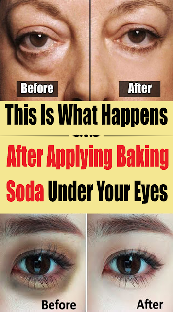 This Is What Happens After Applying Baking Soda Under Your Eyes