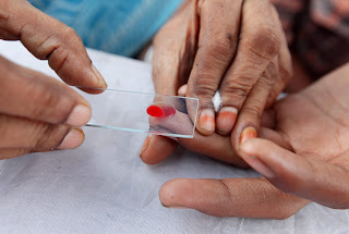 Governu: Malária besik lakon ona iha Timor-Leste