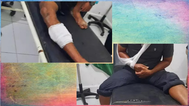 Gegara Bandar Togel, Oknum TNI dan Polri di Papua Berkelahi hingga Baku