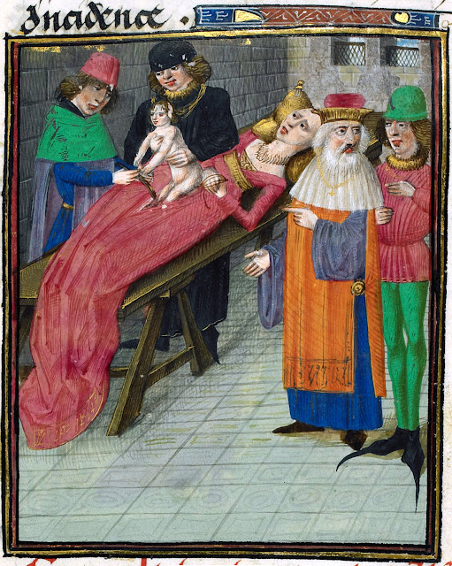 Рождение Юлия Цезаря  на книжной миниатюре 1470-х годов