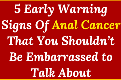 5 Early Warning Signs Anal Cancer That You Shouldn’t Be Embarrassed to Talk About