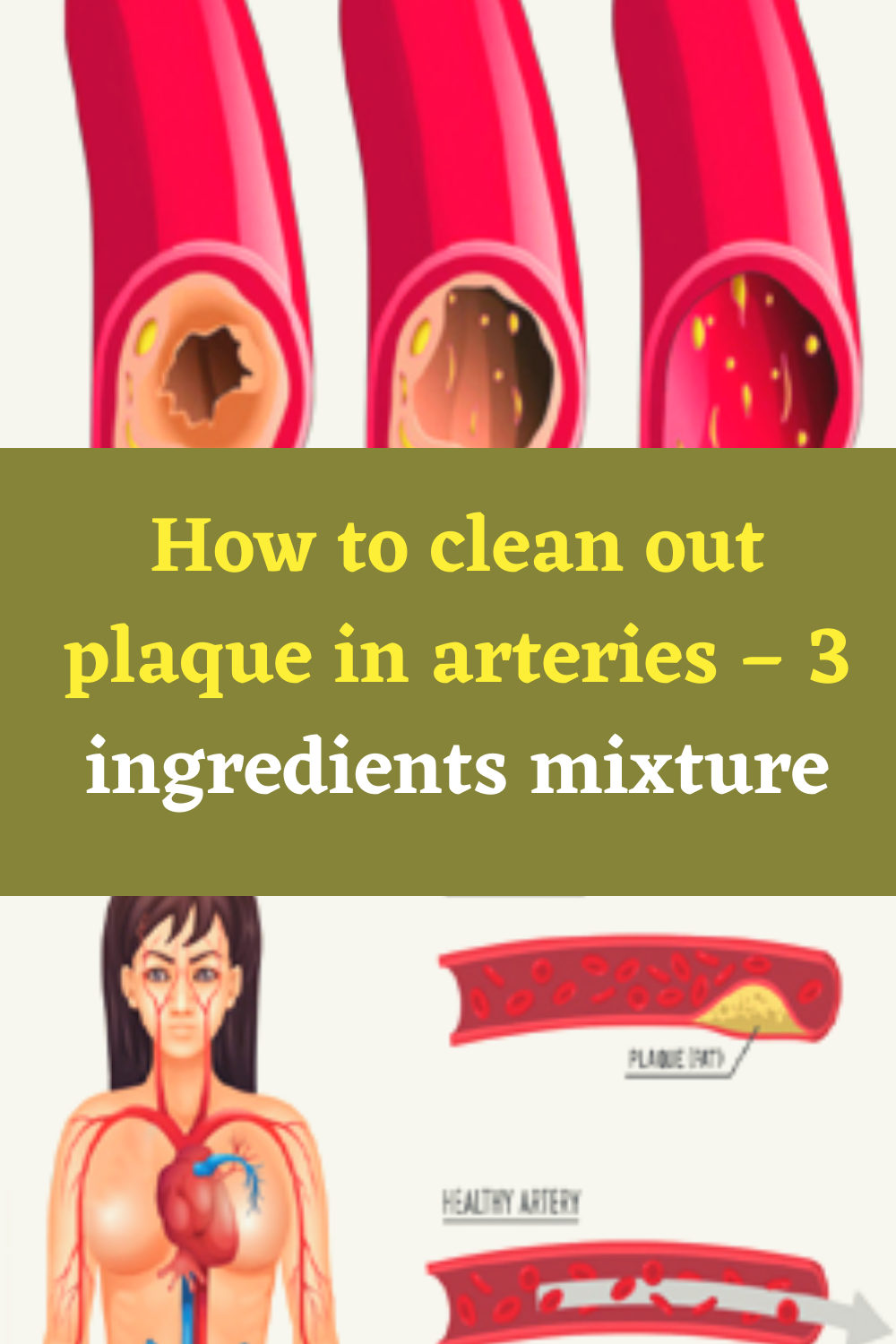 How To Clean Out Plaque In Arteries 3 Ingredients Mixture
