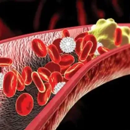 low hdl cholesterol causes low hdl cholesterol causes