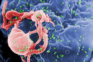 HIV-1 aşısı (yeşil olanlar) uygulanmış bir Lenfosit kültürünün mikrografı