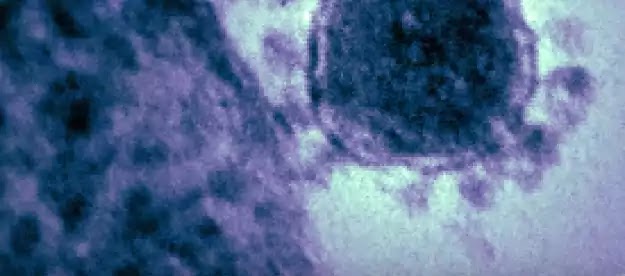 coronavirus update coronavirus update