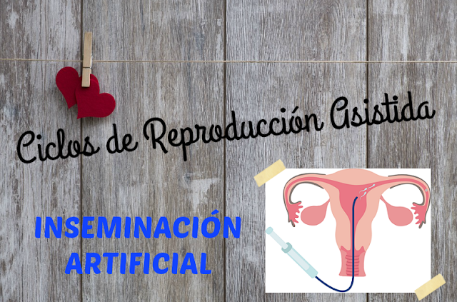 Ciclos de reproducción asistida: Inseminación Artificial (IA)
