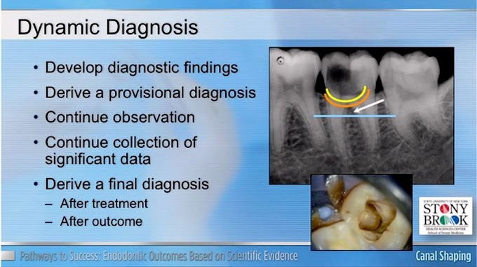 WEBINAR: Endodontology Diagnosis with Dr. George Bruder