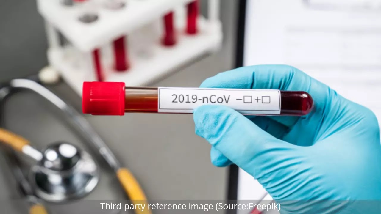 Plasma Therapy for COVID-19 | HealthInsta Plasma Therapy for COVID-19 | HealthInsta