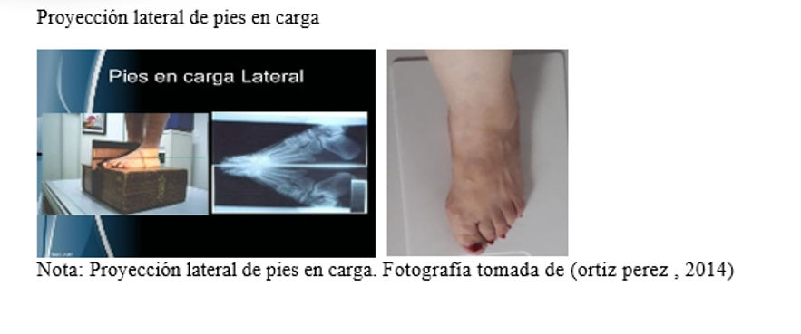 CREACION DE PROTOCOLOS : ESTUDIOS RADIOGRAFICOS MIEMBROS INFERIORES
