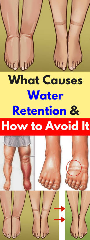 Healthy Central What Causes Water Retention And How To Avoid It
